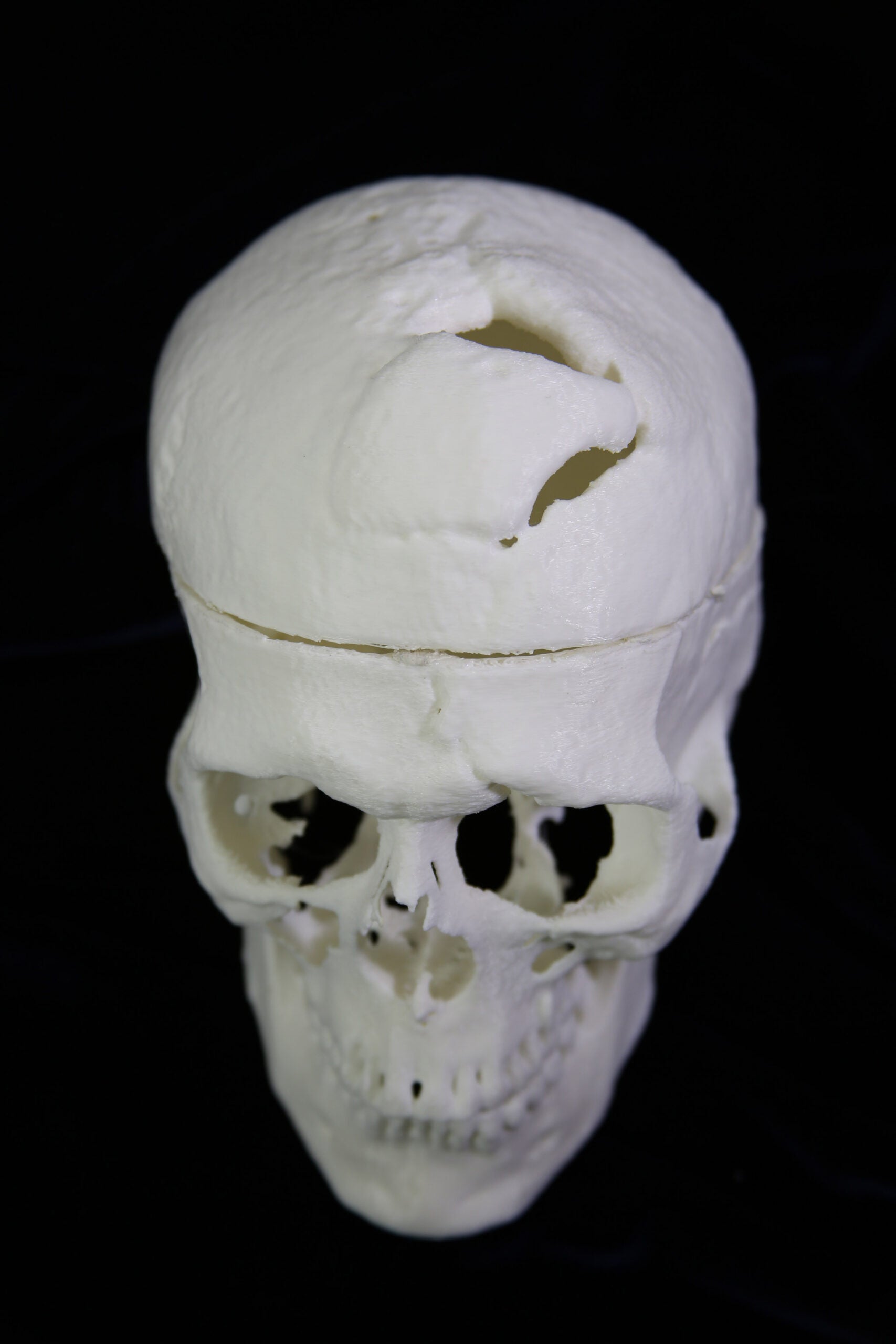 3D printed human skull with a hole in the top