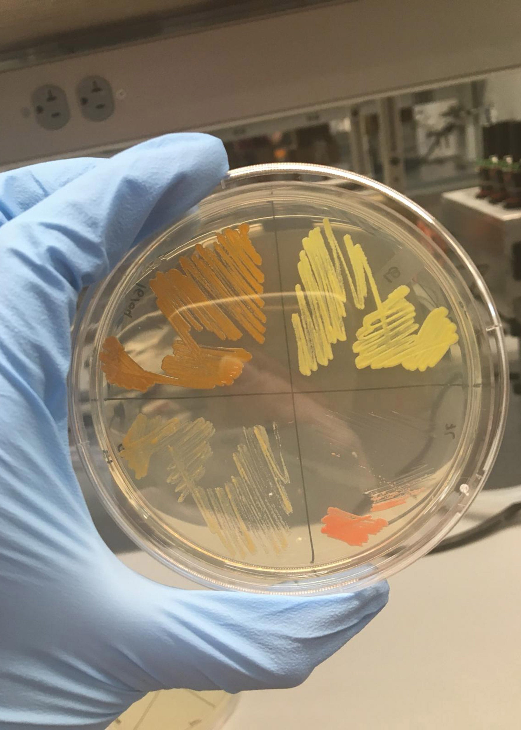 Samples of bacteria.