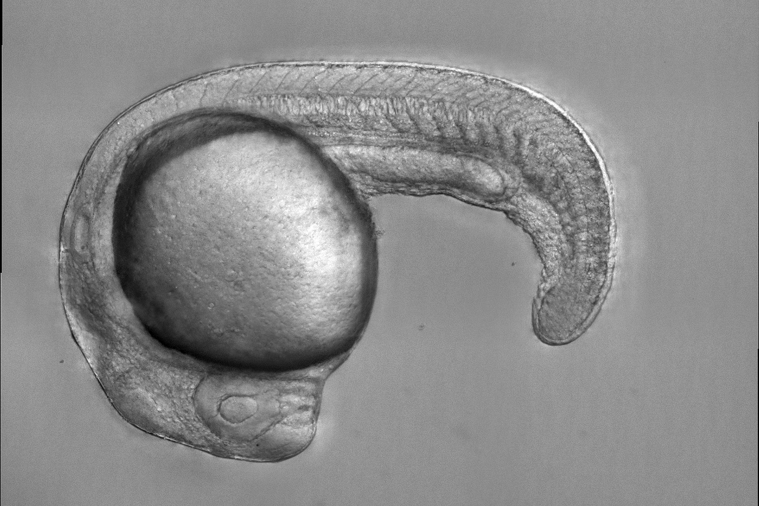 Zebrafish embryo.