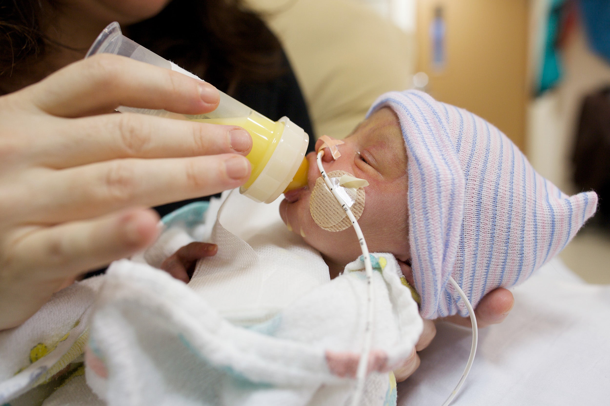 A premature baby feeding on breastmilk.