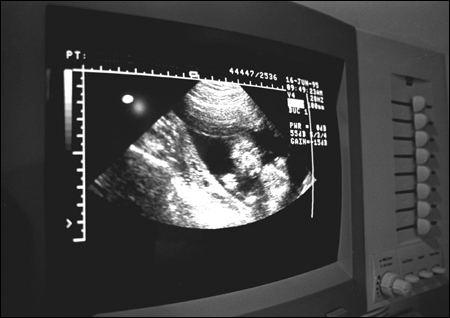 Photograph of ultrasound