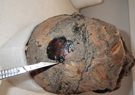 The head of a Chinchorro mummy. Photo courtesy of Marcela Sepulveda