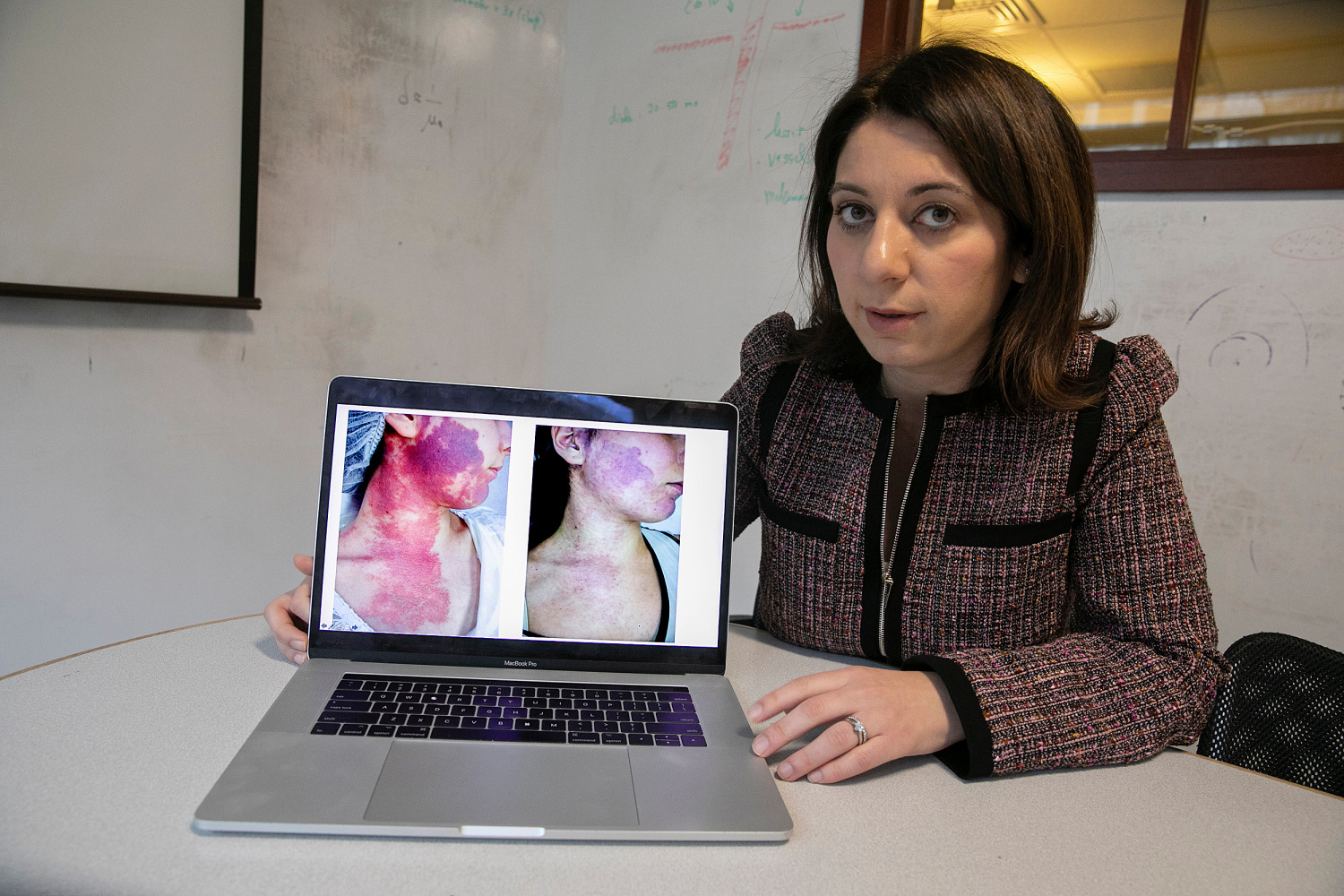 Dr. Lilit Garibyan showing the before and after of surgery on her laptop