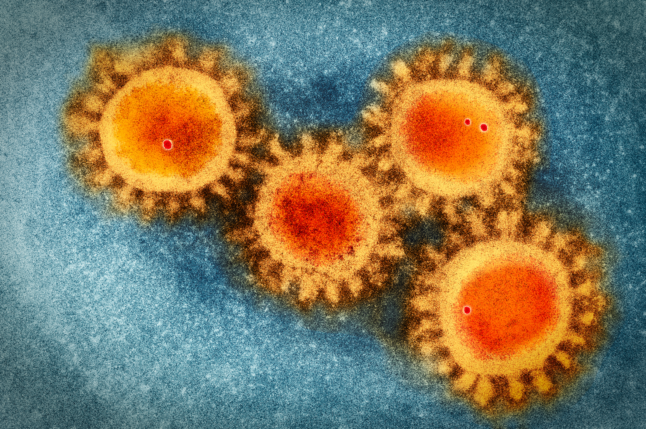 An electron microscopy photo of the coronavirus COVID-19.