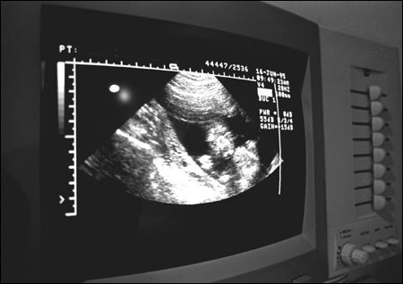 Photograph of ultrasound image