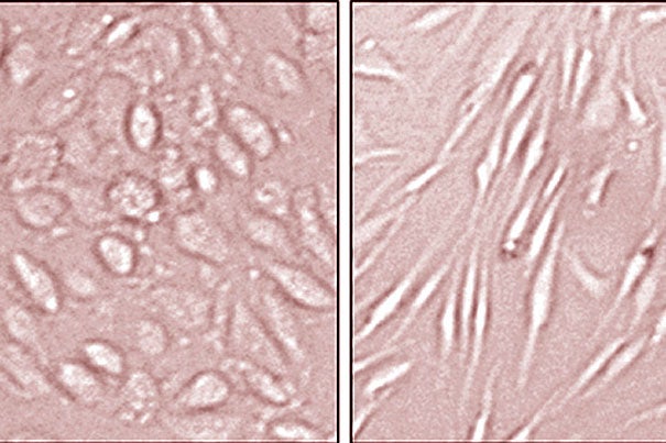 On the left are normal endothelial cells, while those on the right have been reprogrammed into cells nearly identical to adult stem cells, hence the morphological distinctions.