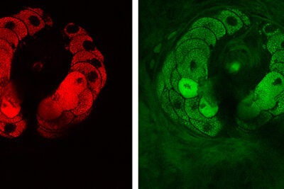 Pictured are structural components of tissue — lipids (red) and proteins (green). The images show a sebaceous gland wrapping around a hair in the viable epidermis of mouse skin. 