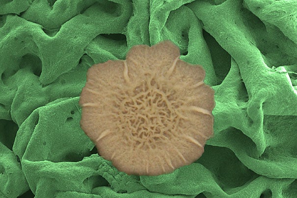 Slimy bacterial coatings known as biofilms (Bacillus subtilis colony superimposed at center) exhibit an unmatched ability to repel a wide range of liquids and even vapors. An electron microscope image shows the biofilm surface's resilient meshwork made from proteins and polysaccharides and assembled into a multiscale, hierarchical structure.