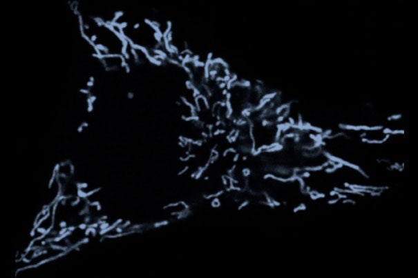 A confocal image of a human cell expressing a fluorescent version of MCU, the newly discovered protein key to mitochondria's ability to absorb calcium.