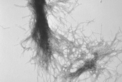 "Diseases such as Huntington's, Parkinson's, and Alzheimer's disease have different causative factors, but they share common themes — such as aggregation of misfolded proteins — and a unifying end point, the degenerative loss of neurons," says Harvard Medical School Professor of Neurology Dimitri Krainc. In this image, transmission electron microscopy demonstrates the fibrillar nature of huntingtin aggregates.