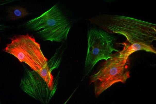  Cultured pericytes (red) and myofibroblasts (green) are two prominent noncancer cells within a tumor.