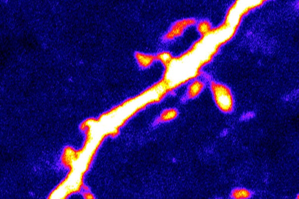 The scientists found that a 24-hour period of fasting — which causes intense hunger in the control mice — was associated with a 67 percent increase in the number of dendritic spines (pictured) on the AgRP neurons. 