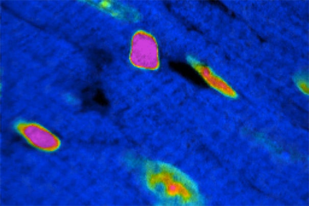 A sophisticated imaging system, multi-isotope imaging mass spectrometry (MIMS), demonstrates cell division in the adult mammalian heart. Researchers were surprised to find that new heart muscle cells primarily arose from existing heart muscle cells, rather than stem cells. 