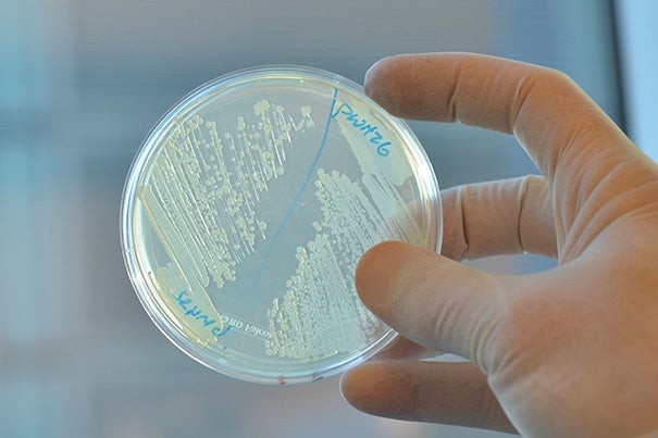 Scientists at Harvard’s Wyss Institute and Boston University interfered with the metabolism of E. coli, shown here, which rendered the bacteria weaker in the face of existing antibiotics.