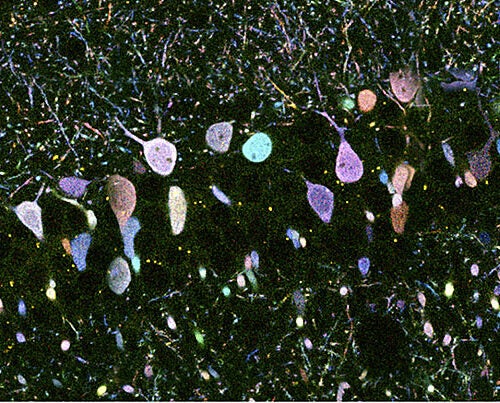 Hippocampal neurons labeled using the improved “Brainbow” technique show 20 large neurons (diameter <5 μm) in 20 distinct colors.
