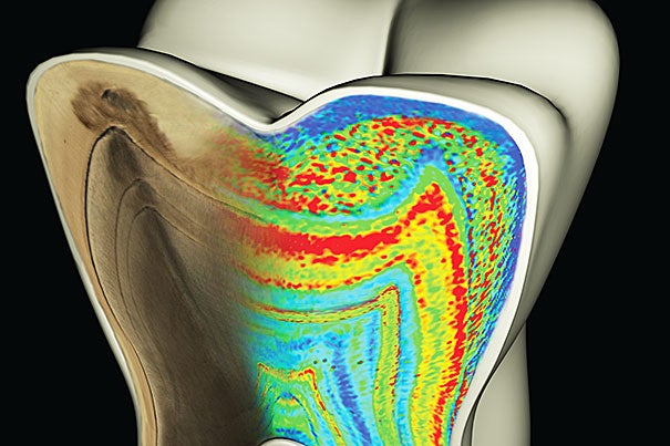 Molar tooth model with the cut face showing color-coded barium patterns merging with a microscopic map of growth lines, which have been accentuated to reflect their ringlike nature.