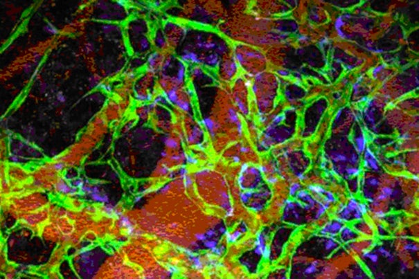 Researchers have developed durable blood vessels  in a mouse model from human induced pluripotent stem cells. This laser microscopy image shows iPSC-generated endovascular cells in green, connective tissue cells in blue, and red blood cells in red. 