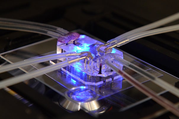 Researchers at the Wyss Institute will explore the uses of organs-on-chips to test the safety and efficacy of medical treatments for radiation sickness. These devices, which are about the size of a computer memory stick, consist of a clear flexible polymer containing hollow microfluidic channels lined by living human cells.