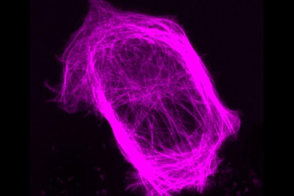 A confocal microscopic image showing the red-tagged GEF-H1 protein, which researchers believe is essential to the immune system's response against viral infection.
