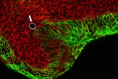 Cells in the embryonic jaw of a mouse (red) squeeze a cell-sized, spherical oil droplet (with blue border, shown with arrow). The droplet deforms like a water balloon, and the degree to which it deforms allows scientists to calculate the pressure cells exert on their neighbors. 