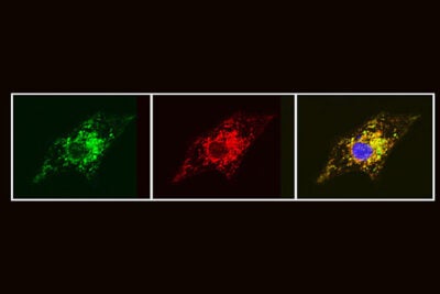 The series of images shows how inserting modified RNA into diseased cells causes the cells to produce functioning versions of the TAZ protein (from left, green), which correctly localize in the mitochondria (red). When the images are merged to demonstrate this localization, green overlaps with red, giving the third image a yellow color around its edges.