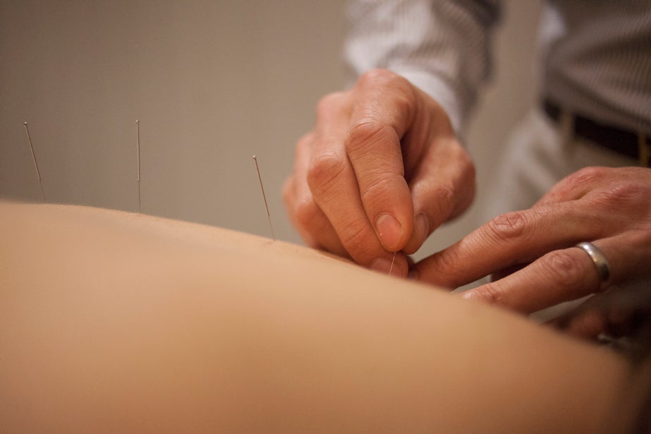 Jeffrey Matrician performs acupuncture at the Center for Wellness