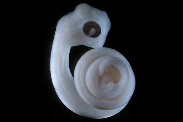 Python embryo at 11 days after oviposition (egg-laying). The right hemipenis (genitalia) bud and vestigial limb-bud can be seen near the tail end of the embryo, in the center of the tail "spiral," appearing as two white "blobs."