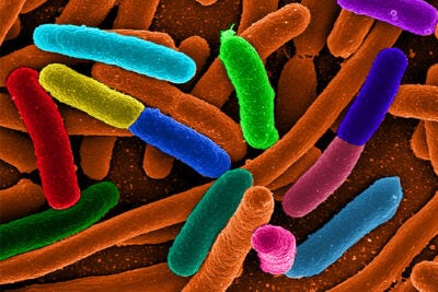 In a recent study, Wyss Institute researchers genetically modified E. coli bacteria to produce up to 30-fold more quantities of chemicals at a thousand-fold faster rate than previously possible. 