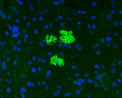 Mesenchymal stem cells (green) colonize a pancreatic islet in a preclinical model of diabetes. The blue dots represent the nuclei of cells within the islet.