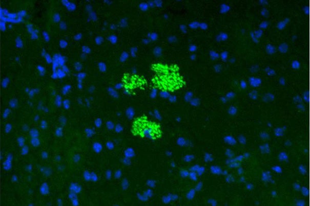 Mesenchymal stem cells (green) colonize a pancreatic islet in a preclinical model of diabetes. The blue dots represent the nuclei of cells within the islet.