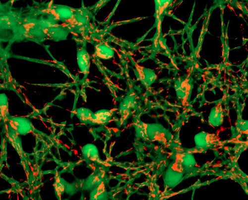 Researchers have proposed a new model of Alzheimer’s that suggests mitochondria — cellular power plants — might be at the center of the disease. Pictured are neurons with mitochondria.
  