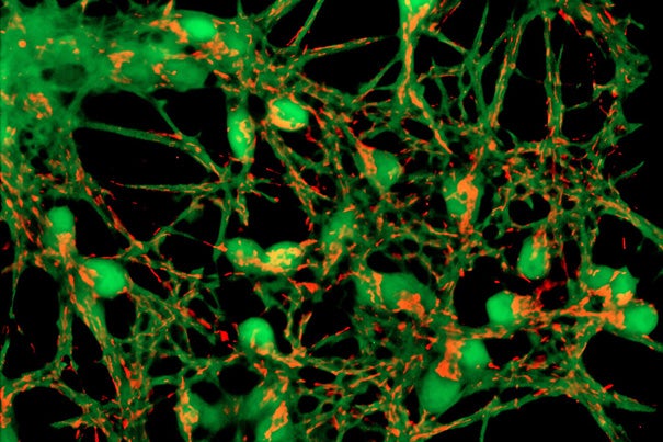 Researchers have proposed a new model of Alzheimer’s that suggests mitochondria — cellular power plants — might be at the center of the disease. Pictured are neurons with mitochondria.
  