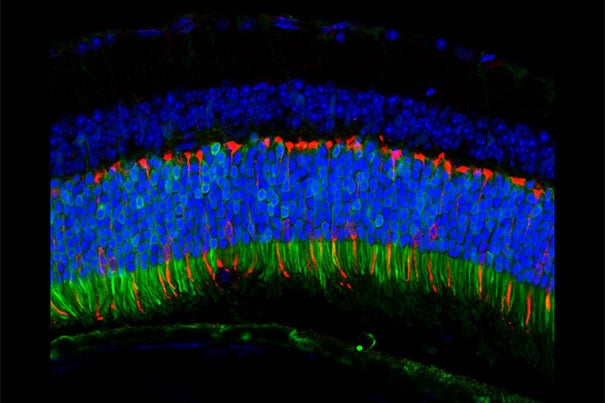 The Anc80 virus delivers genes to the mouse retina that fluoresce green when expressed. Pictured here, the delivered genes are active in the retina’s color-detecting cells. 