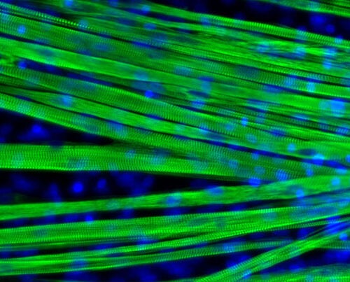 Researchers have been able to grow differentiated muscle fibers (green) in the lab. The nuclei are shown in blue. 