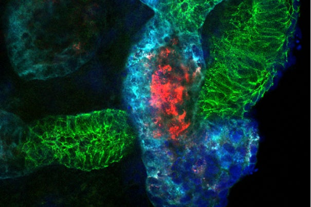 Researchers modeled kidney development and injury in kidney organoids (shown here), demonstrating that the organoid culture system can be used to study mechanisms of human kidney development and toxicity. 