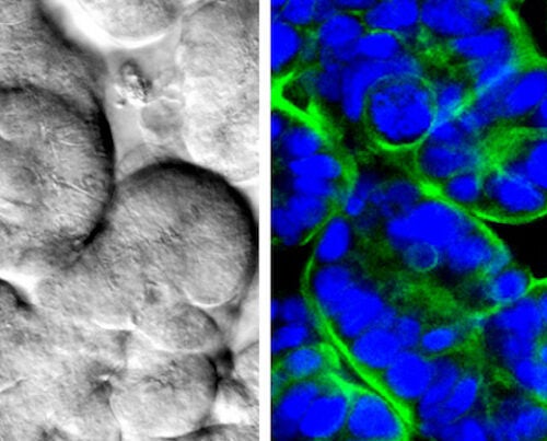 Human intestinal epithelial cells cultured in the Wyss Institute’s human-gut-on-a-chip form differentiated intestinal villi when cultured in the presence of lifelike fluid flow and rhythmic, peristalsis-like motions. Here the villi are visible using a traditional microscope (left) and a confocal microscope (right). Fluorescent antibodies stain the nuclei blue and their specialized membranes, known as apical brush borders, green. 