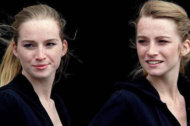 Researchers looked at more than 200,000 twins who participated in the Nordic Twin Study of Cancer. The twins were followed over an average of 32 years between 1943 and 2010. 