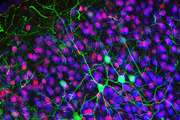 Callosal projection neurons (green) in the cerebral cortex. In 2004, Jeffrey Macklis’ lab was the first to describe abnormal development in this type of neuron.