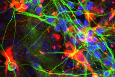 An image of  the type of cells studied by Young-Pearse and colleagues shows human astrocytes (red) and neurons (green) derived from iPS cells. 