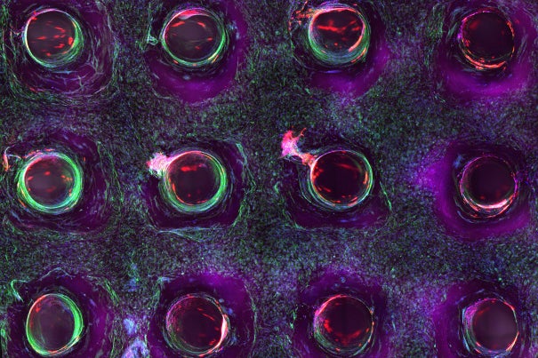 A confocal microscopy image shows a cross-section of a 3-D-printed, 1-centimeter-thick vascularized tissue. Movement toward the development of bone cells through stem cell differentiation can be seen after one month of active perfusion of fluids, nutrients, and cell growth factors. The structure was fabricated using a novel 3-D bioprinting strategy invented by Jennifer Lewis and her team at the Wyss Institute and Harvard SEAS. 