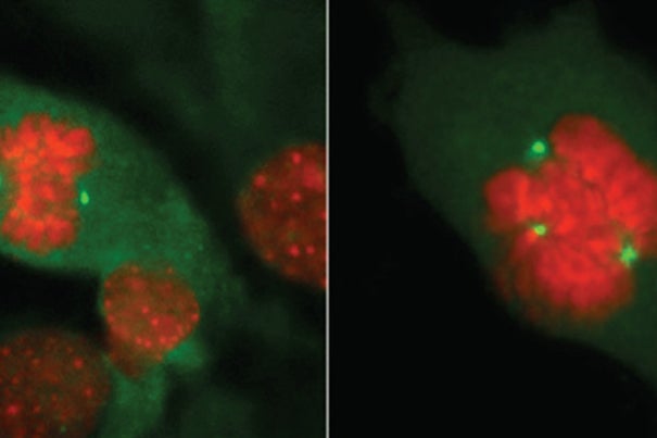 The study of normal cell division in a breast (left) versus the mutation BRCA1 or BRCA2 (right) has expanded as Harvard researchers examine levels of Ki67, a molecular marker in healthy breast tissue that can predict a woman’s risk of getting breast cancer.