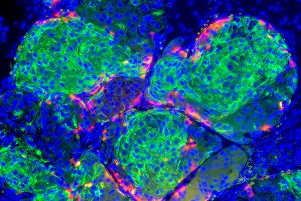 Human stem-cell-derived beta cells that have formed islet-like clusters in a mouse.  Cells were transplanted to the kidney capsule and photographed 2 weeks later, by which time the beta cells were making insulin and had cured the diabetes in the mouse.