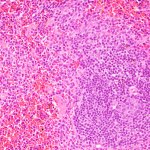 Microscope image of a healthy spleen.