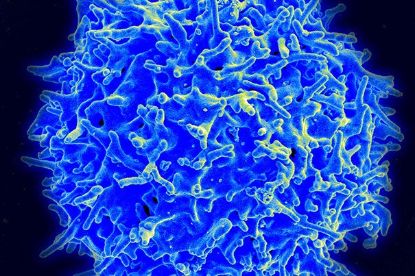 Scanning electron micrograph of a human T lymphocyte (also called a T cell) from the immune system of a healthy donor. Researchers have found that the molecular communication in healthy T cells is fundamentally different than that of overworked T cells, suggesting that a method of increasing their longevity could be discovered.
