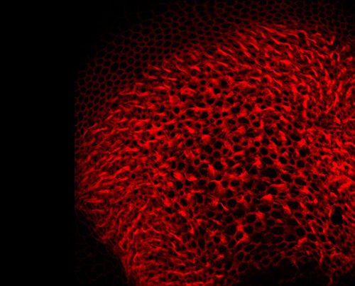 To super-charge a specific virus as a gene carrier into the inner ear, the team used a form of the virus wrapped in protective bubbles called exosomes (tiny bubbles made of cell membrane). Those cells naturally bud off exosomes that carry the virus inside them.
