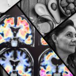 Harvard Alzheimers Research
