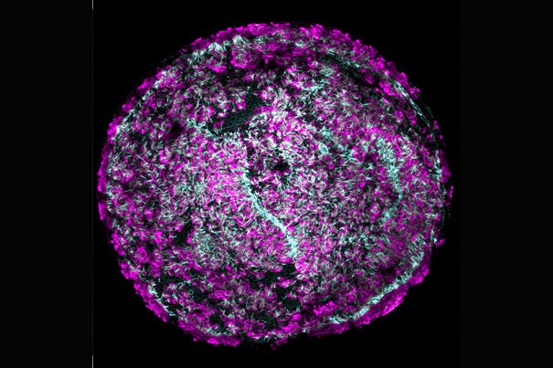 Using a drug cocktail in a petri dish, researchers can now grow colonies of sound-sensing hair cells (magenta) with intricate hair bundles (cyan) from a single cochlear hair cell. This finding may accelerate the development of new therapies for hearing loss. 
