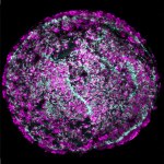 Using a drug cocktail in a petri dish, researchers can now grow colonies of sound-sensing hair cells (magenta) with intricate hair bundles (cyan) from a single cochlear hair cell. This finding may accelerate the development of new therapies for hearing loss. 