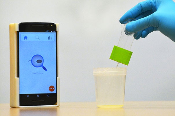A smartphone-based semen analyzer can be used to test for male infertility. The 3-D printed setup costs less than $5 and can analyze most semen samples in fewer than 5 seconds.