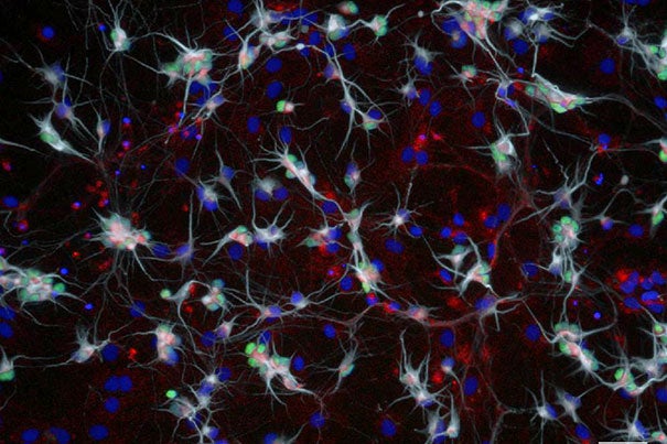 SMN protein (red) is necessary for the survival of spinal cord neurons (motor neurons) responsible for breathing and all movement. Harvard researchers have found a compound that stabilized this protein in mouse and human motor neurons. This may lead to the development of new treatments for motor neuron diseases including Spinal Muscular Atrophy and Lou Gehrig’s disease. 